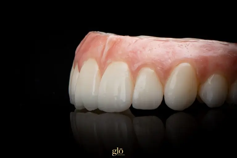 Inside our smile lab