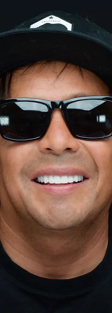 Glo patient smiling outdoors after a double-arch All-on-6 restoration