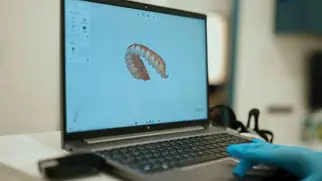 Laptop showing a 3D scan of a patient's teeth