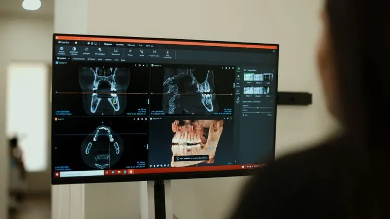 Dental X-rays and a CBCT scan open on a treatment-planning monitor