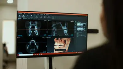 Dental X-rays and a CBCT scan open on a treatment-planning monitor