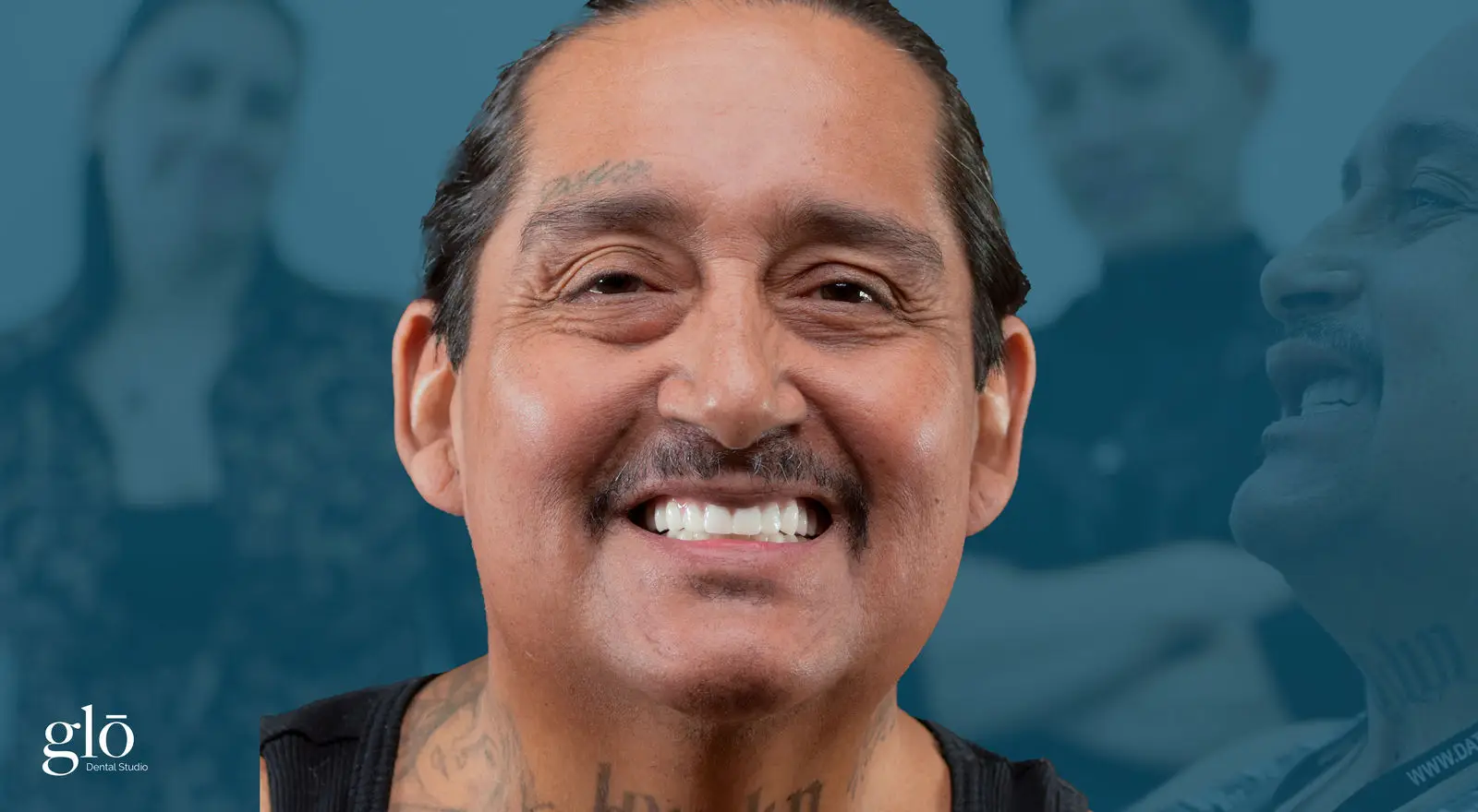 Patient smiling after treatment