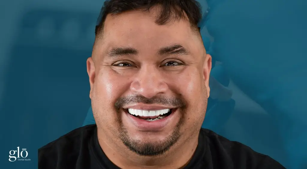Patient smiling after treatment